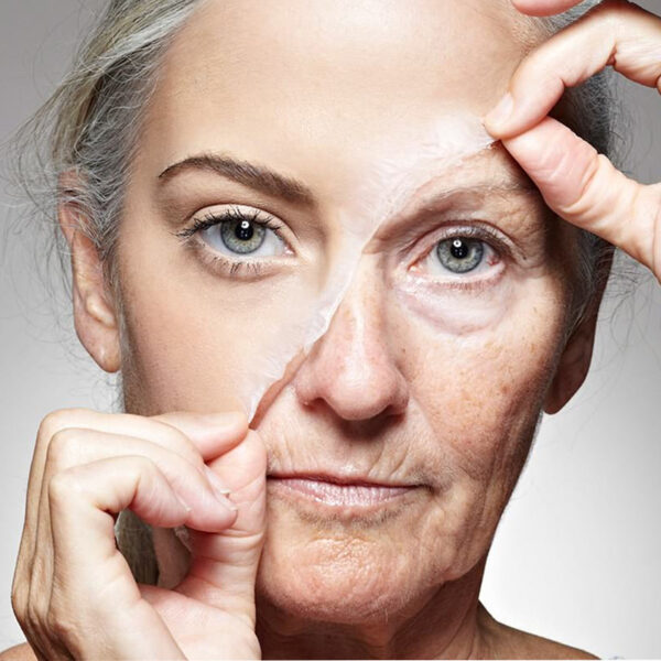 Chăm sóc da lão hoá tại Lumina Clinic – Dưỡng sâu, xóa nhăn, tái tạo làn da tươi trẻ